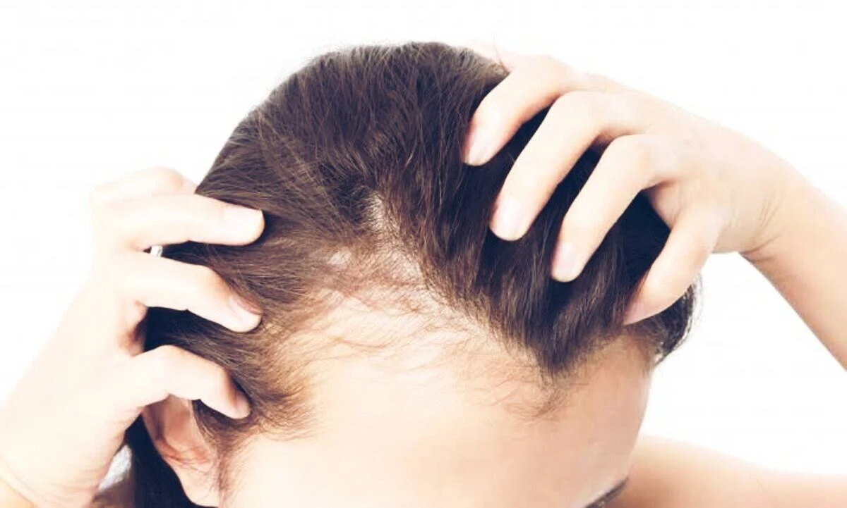 5 Best Amazing Foods जो बालों का झड़ना, पतला होना रोकते हैं: in 5 Days Stop Hair Fall or Loss,बालो का टूटना कैसे रोके, बादाम, गाजर, करी,आंवला, छाछFood