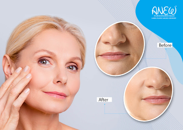 wrinkle reduction