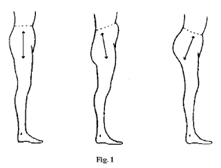 Neutral pelvis, posterior pelvic tilt and anterior pelvic tilt