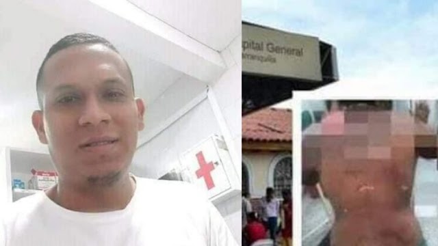 Suegra quemó a su yerno con  agua hirviendo porque siempre llegaba a la hora del almuerzo   
