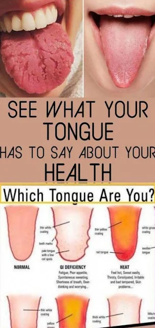 What Your Tongue Is Trying To Tell You About Your Health