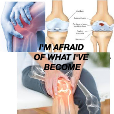 What is bone pain bone pain make your close life.