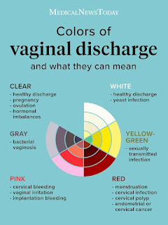 ISOLATION AND SENSITIVITY OF BACTERIA ISOLATE FROM VAGINAL DISCHARGE TO ANTIBIOTICS