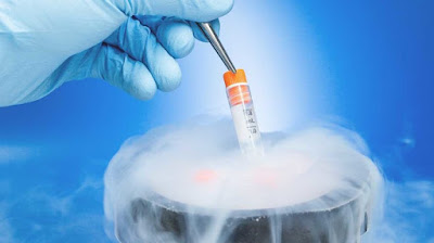 The goal of cell cryopreservation is to preserve biological samples at a cryogenic temperature while maintaining the fine structure of the cells.