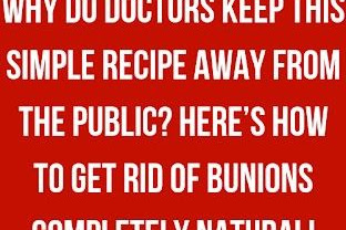 Why do Doctors Keep this Simple Recipe away from the Public? Here’s how to get rid of Bunions Completely Natural!
