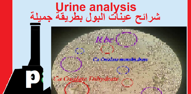 شرائح عينات البول بطريقة جميلة URINE ANALYSIS