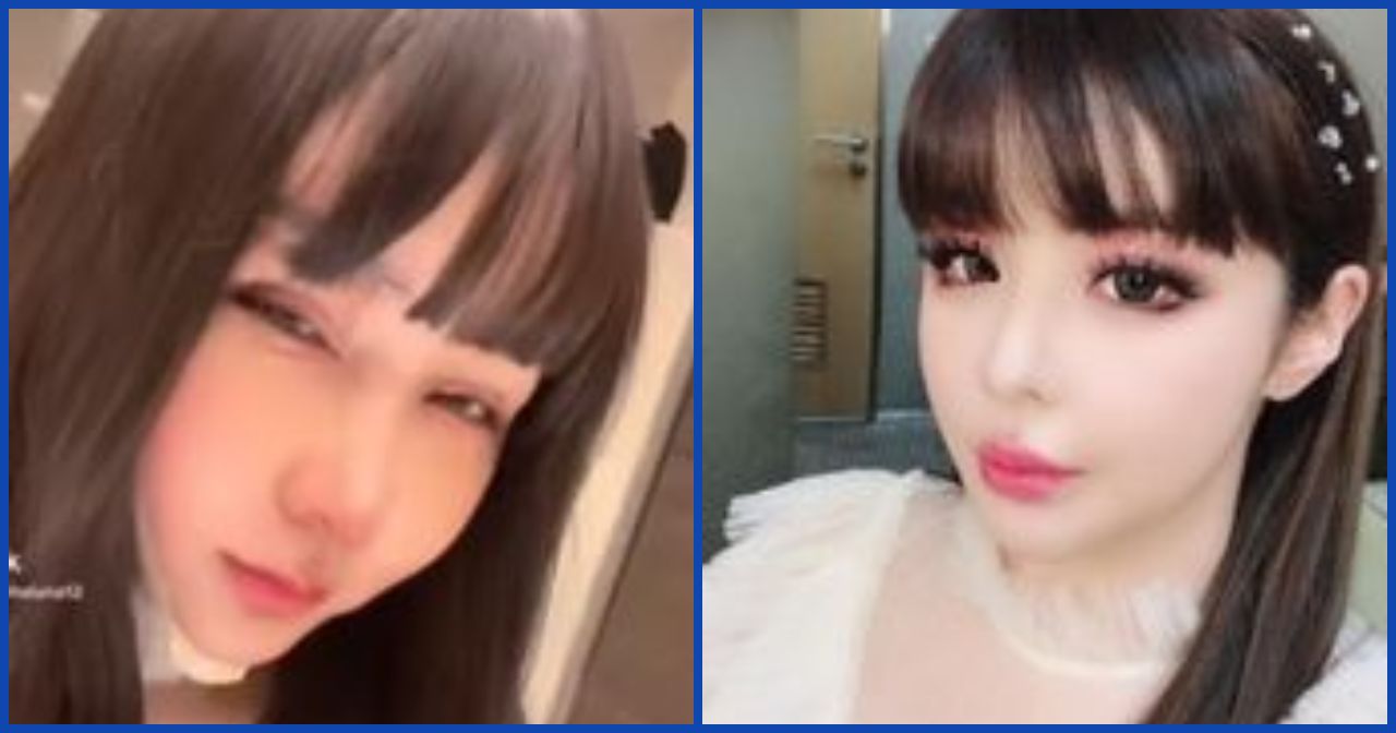 Rela Bertaruh Nyawa di Meja Operasi Demi Dapatkan Wajah Baru, Penampilan Lucinta Luna Makin Bikin Pangling, Disebut Mirip Park Bom 2NE1!