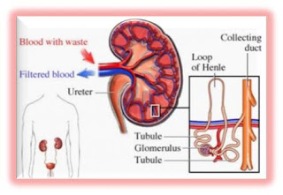 Nursing Care Plan for Glomerulonephritis