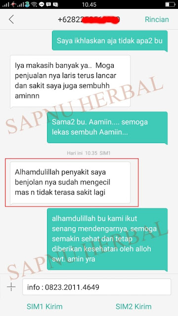 Obat Uci-Uci Alami, Ampuh Menyembuhkan Uci-Uci Secara Alami Tanpa Operasi