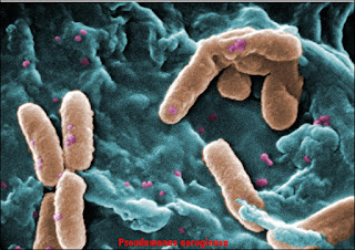 Las bacterias más peligrosas del mundo