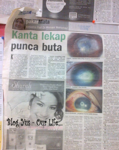 Anda pengguna kanta lekap??  ~Blog Yus - Our Life~