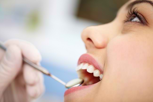 Tips Menjaga Kesehatan Gusi dan Mencegah Gigi Berlubang