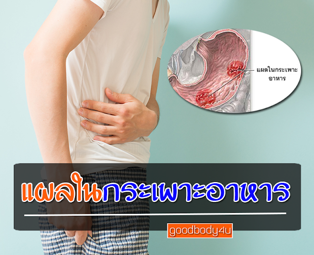 อาหารไม่ย่อย, กระเพาะอักเสบ ,ลำไส้อักเสบเรื้อรัง ,ท้องอืด, goodbody4u, นิชาภา