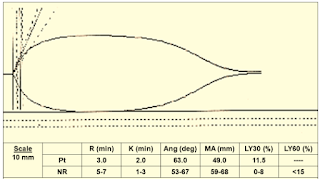 Viscoelastic Measures of Coagulation