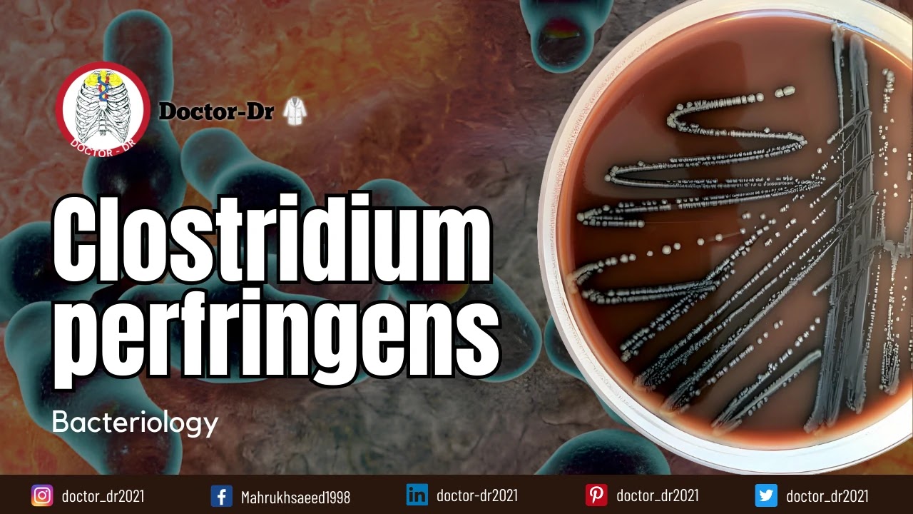 Clostridium perfringens: Understanding the Basics