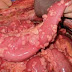 Peritoneal Mesothelioma Age