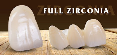 Phân vân có nên trồng răng sứ zirconia giá rẻ-1
