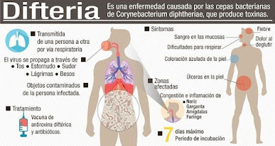 ¿Que es la Difteria?. Situación en Venezuela. Epidemiología.