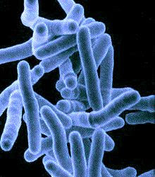 Tuberculosis Symptoms