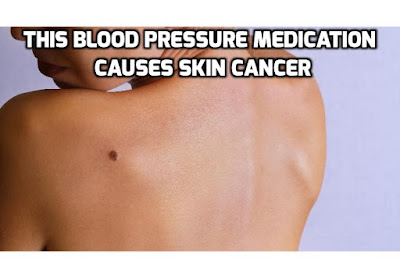 A new Danish study, published in the Journal of the American Academy of Dermatology reveals shocking details about one of the most common blood pressure medication used. It increases your risk of two types of skin cancers scary 700%