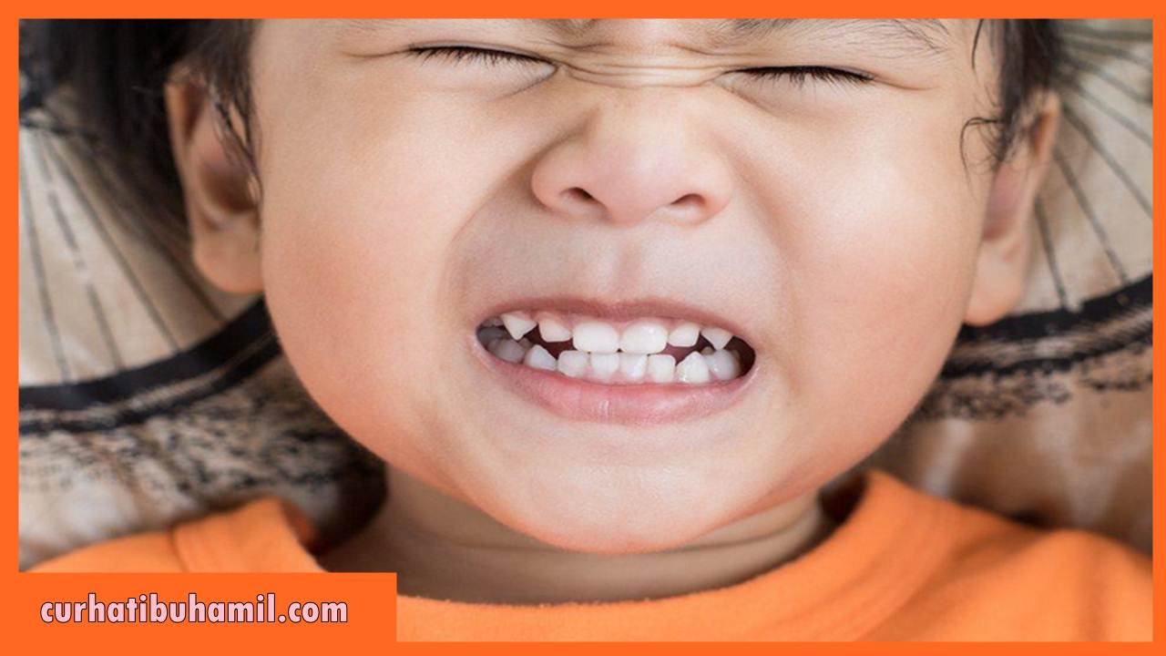 Bagaimana cara mengatasi gigi kuning pada bayi?