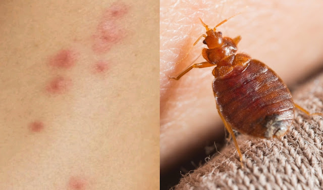 Bed bug  How do I get rid of bed bugs in my bed? How do people get bed bugs? How do I know if I have a bed bug on me? What kills bed bugs instantly? What kills bed bugs naturally? Can bed bugs go away? Can bed bugs live in your hair? Are bed bugs caused by poor hygiene? How long do bed bugs live? Can you see bed bugs with the naked eye? How do you know if you slept in a bed with bed bugs? Can you feel bed bugs on you? Can I remove bed bugs myself?