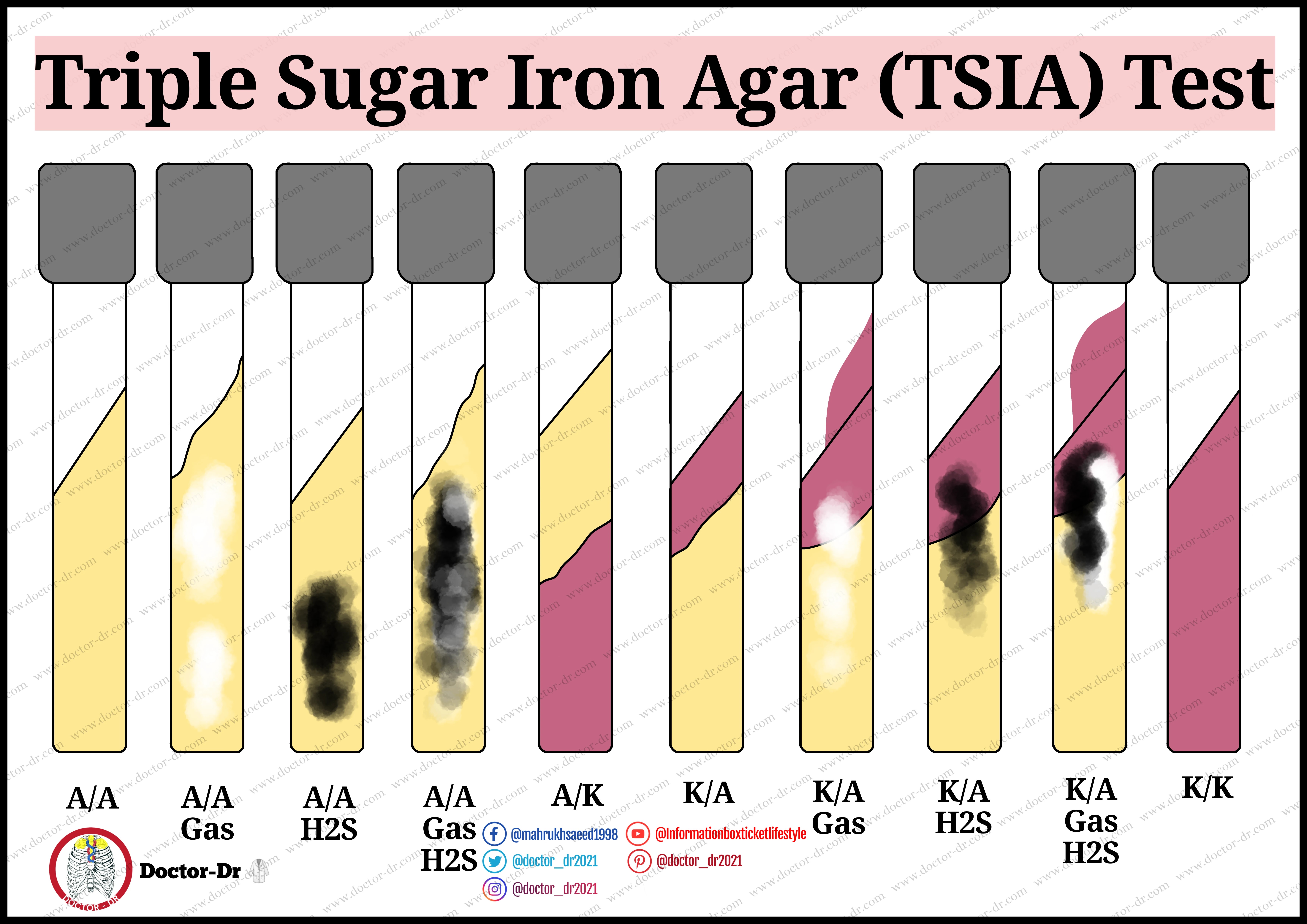 Result and Interpretation of TSIA Test