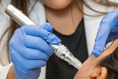 At Least Three Women Contract H.I.V. Following 'Vampire Facial' Treatments