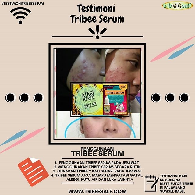 testimoni tribee serum