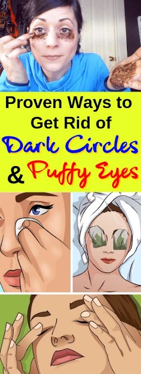 Tips to Get Rid of Under Eye Circles