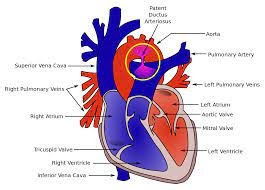 Perbedaan Antara Pembuluh Arteri dan vena lengkap Dengan Bagan