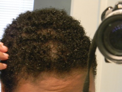 head and shoulders review 044 head and shoulders review 044