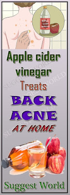 Treat the back acne quickly and effectively!