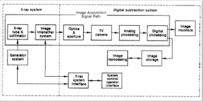 Block diagram of Digital subtraction angiography