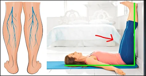 Top 7 Exercises To Prevent Varicose Veins