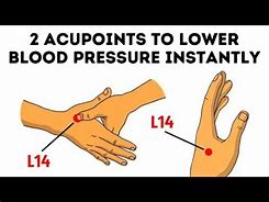 HIGH BLOOD PRESSURE  OR  HYPERTENSION