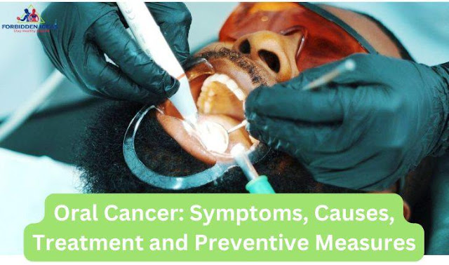 Oral Cancer: Symptoms, Causes, Treatment and Preventive Measures
