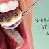 Răng bị khểnh có nên niềng hay không?