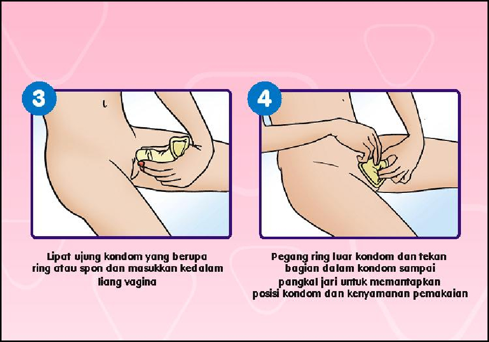 Catatan Liza Mengenal Kondom  Wanita  Female Condom 