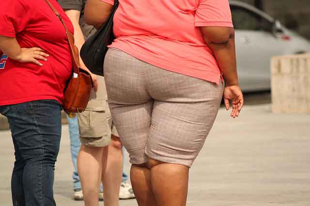 Obesity, Causes and Consequences You May Face