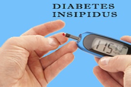 Diabetes Insipidus Diagnosis, Causes, Symptoms & Successful Treatments