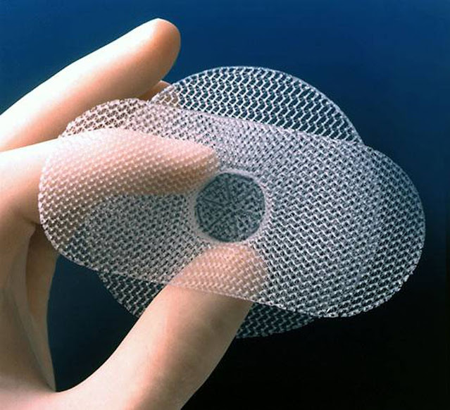 Hernia Mesh Devices Market
