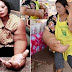  Ngeri !! Hindarilah... Gara Gara Sering mengkonsumsi Makanan ini Kelainan Langka Terjadi Pada , Tangan Wanita Ini Jadi Besar. Beratnya Mencapai 9,5 Kg 