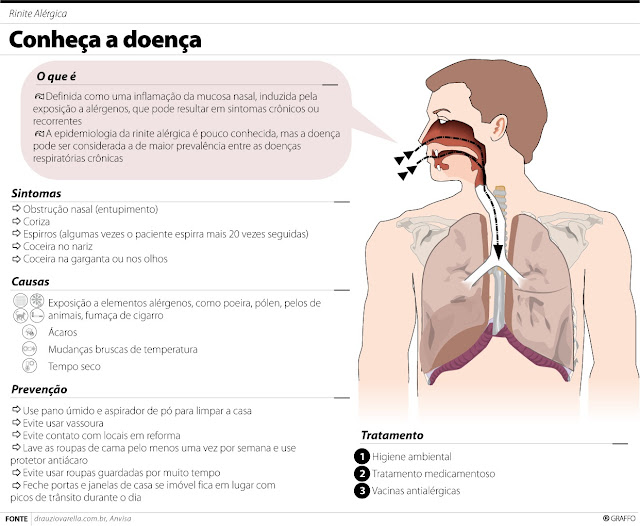 A rinite e seu caminho até atingir os ouvidos - Terapia dos Cones Chineses - São José (SC)