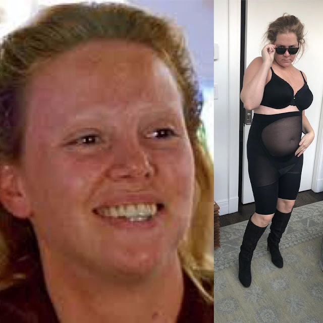 Amy Schumer #10yearchallenge