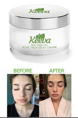 Best Acne Cream