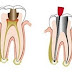 Răng sứ bị ê khi uống lạnh - Cách khắc phục nhanh