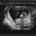Large Plum - 12 week Baby Moore