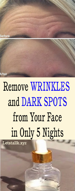 Facial Oil for remove Wrinkles, Dark spots IN JUST 5 NIGHTS