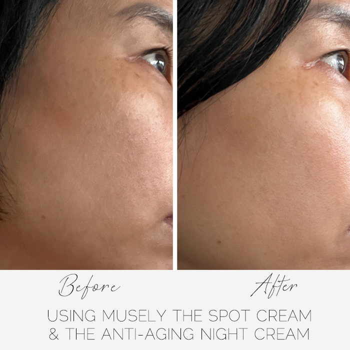 Musely, Musely Review, Musely FaceRx, Musely The Spot Cream, Musely The Anti-Aging Night Cream